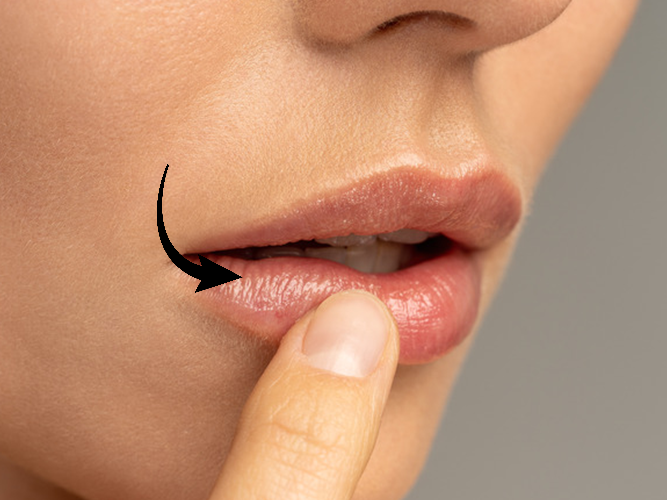 lipstick lines